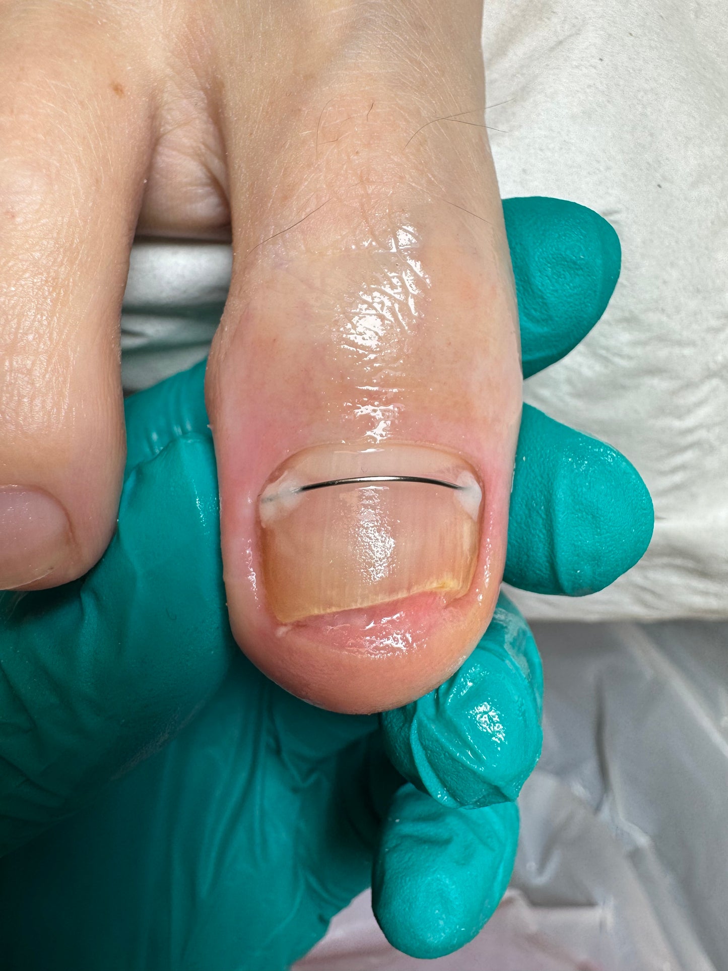 Advanced pedicure course - Titanium NiTi, March 22-23