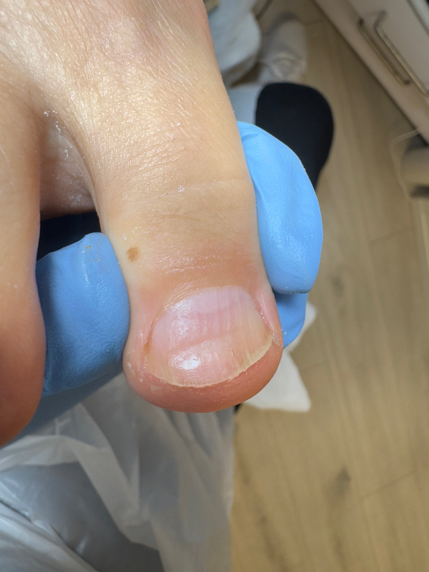 Advanced pedicure course - skin and nail pathologies
