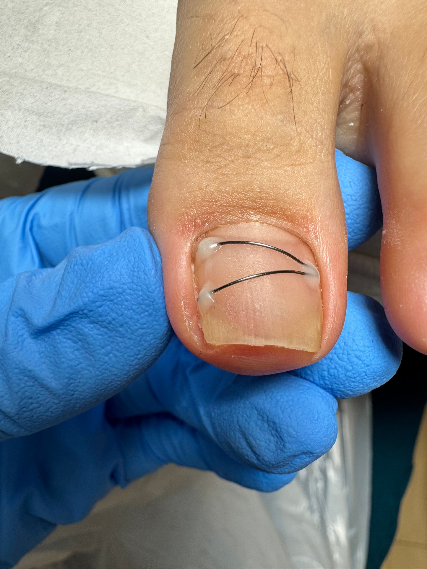 Advanced pedicure course - Titanium NiTi, March 22-23